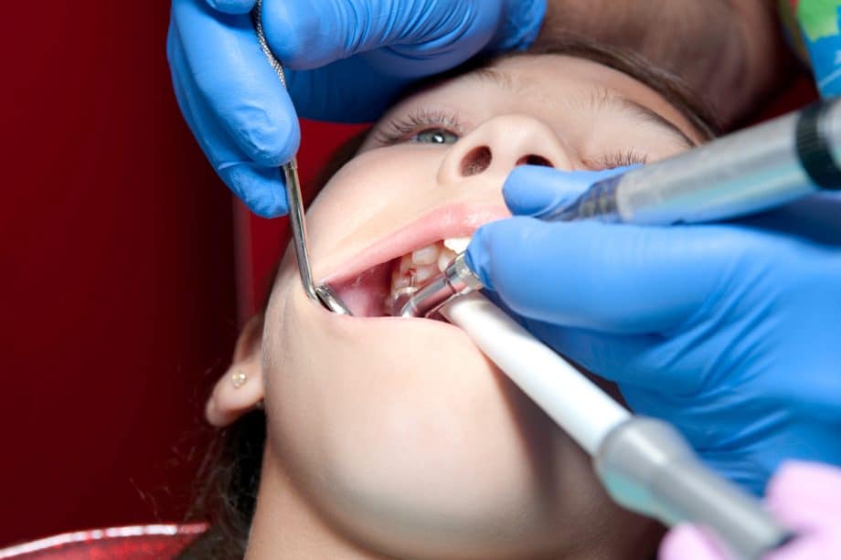 How Long Can You Go Without Getting A Root Canal?